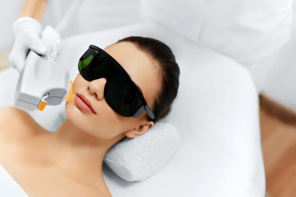 Unlocking Radiant Skin With BBL Laser In Tampa